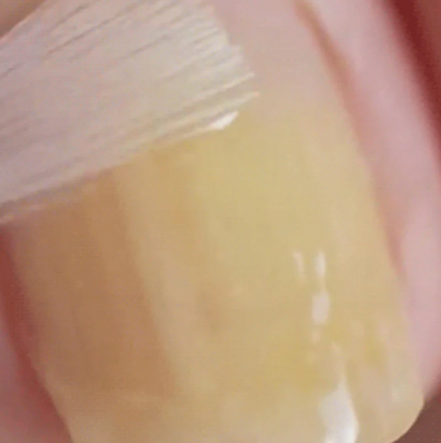 Last Day Of Discount 🔥 Nail Repair & Antifungal Solution